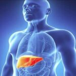 क्या आपको भी है फैटी लिवर की समस्या- तो सिर्फ खराब डाइट ही नहीं, ये आदतें भी हो सकती हैं जिम्मेदार