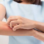 बदलते मौसम में स्किन पर खुजली और दानों से हैं परेशान, तो इन घरेलू नुस्खों से पाएं राहत