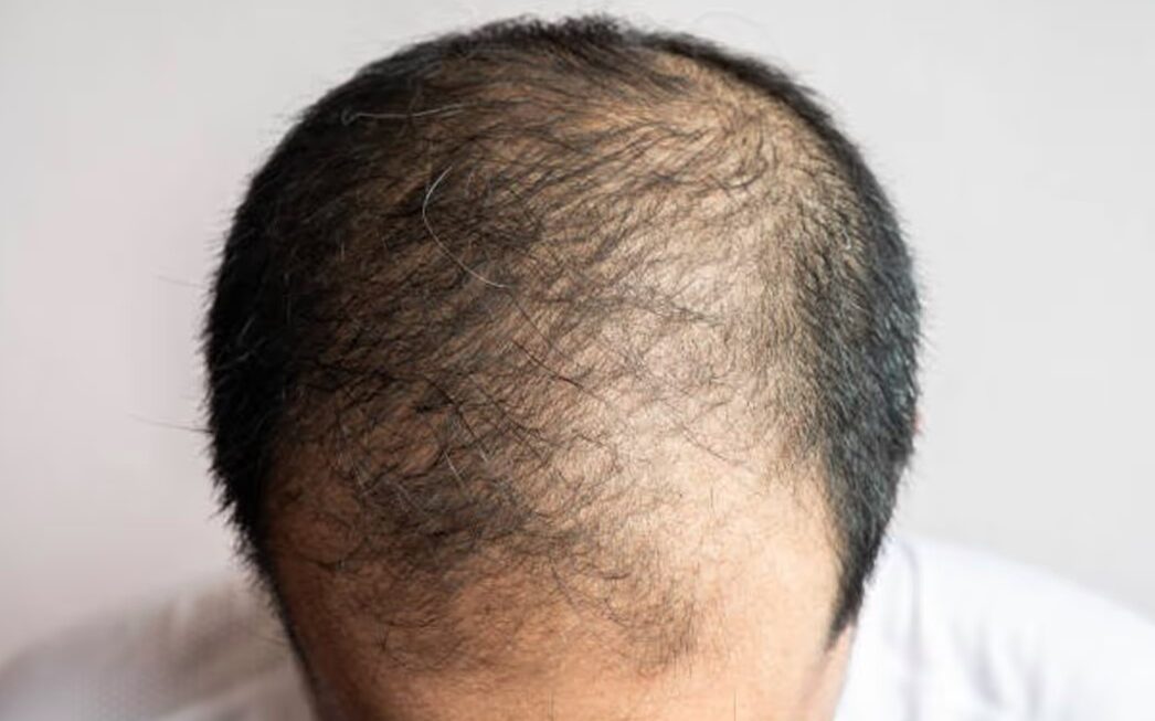 क्या सच में हेलमेट पहनने से झड़ते हैं बाल? जानिए हकीकत