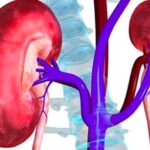 बदलती जीवनशैली और अनियमित खान-पान से बढ़ रहा किडनी रोग का खतरा, डॉक्टरों ने दी चेतावनी